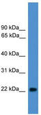 Nudix Hydrolase 16 Like 1 antibody, TA346643, Origene, Western Blot image 