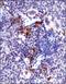 ATM Serine/Threonine Kinase antibody, GTX30636, GeneTex, Immunohistochemistry paraffin image 