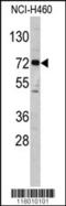 Elongator Acetyltransferase Complex Subunit 2 antibody, TA324752, Origene, Western Blot image 