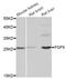 Fibroblast Growth Factor 9 antibody, STJ28457, St John