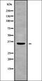 Solute Carrier Family 30 Member 2 antibody, orb336206, Biorbyt, Western Blot image 