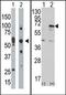 Eukaryotic Translation Initiation Factor 2 Alpha Kinase 2 antibody, AP15148PU-N, Origene, Western Blot image 