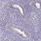 Piwi Like RNA-Mediated Gene Silencing 1 antibody, HPA018798, Atlas Antibodies, Immunohistochemistry paraffin image 