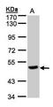 Carboxypeptidase Q antibody, orb69770, Biorbyt, Western Blot image 