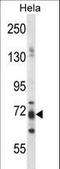 Praja Ring Finger Ubiquitin Ligase 1 antibody, LS-C163745, Lifespan Biosciences, Western Blot image 