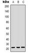 Chromobox 3 antibody, LS-C368789, Lifespan Biosciences, Western Blot image 