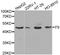Coagulation Factor IX antibody, STJ23601, St John