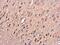 Protein Kinase C Alpha antibody, GTX111252, GeneTex, Immunohistochemistry paraffin image 