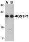 Glutathione S-transferase P 1 antibody, NBP1-76857, Novus Biologicals, Western Blot image 