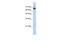 Zinc Finger And SCAN Domain Containing 12 antibody, A13982, Boster Biological Technology, Western Blot image 