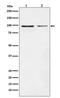 Dynamin 1 antibody, M02536-1, Boster Biological Technology, Western Blot image 