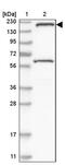 Structural Maintenance Of Chromosomes 4 antibody, PA5-56150, Invitrogen Antibodies, Western Blot image 