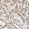 HSF antibody, HPA008888, Atlas Antibodies, Immunohistochemistry paraffin image 