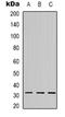 C1QL2 antibody, orb319008, Biorbyt, Western Blot image 