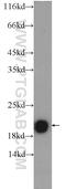 Transmembrane Protein 35A antibody, 24786-1-AP, Proteintech Group, Western Blot image 