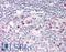 TPX2 Microtubule Nucleation Factor antibody, LS-B11806, Lifespan Biosciences, Immunohistochemistry paraffin image 