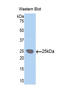 Lysyl Oxidase Like 1 antibody, LS-C301836, Lifespan Biosciences, Western Blot image 