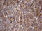 Thyroglobulin antibody, LS-C793874, Lifespan Biosciences, Immunohistochemistry paraffin image 