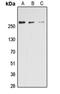 Acetyl-CoA Carboxylase Alpha antibody, orb315750, Biorbyt, Western Blot image 