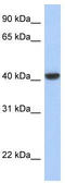 Jun Proto-Oncogene, AP-1 Transcription Factor Subunit antibody, TA330130, Origene, Western Blot image 