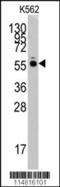 Histidyl-TRNA Synthetase antibody, 62-997, ProSci, Western Blot image 