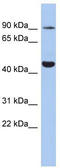 Potassium Voltage-Gated Channel Subfamily H Member 2 antibody, TA338747, Origene, Western Blot image 