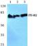 Inter-Alpha-Trypsin Inhibitor Heavy Chain 2 antibody, A07196-1, Boster Biological Technology, Western Blot image 