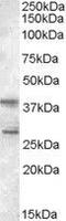 Src Kinase Associated Phosphoprotein 2 antibody, GTX89599, GeneTex, Western Blot image 