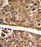 Malate Dehydrogenase 1 antibody, PA5-35307, Invitrogen Antibodies, Immunohistochemistry paraffin image 