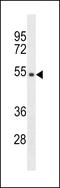 Transmembrane Protein With Metallophosphoesterase Domain antibody, 60-410, ProSci, Western Blot image 