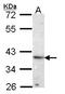 ATPase H+ Transporting Accessory Protein 2 antibody, LS-C109539, Lifespan Biosciences, Western Blot image 