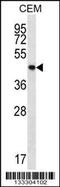 Protein Tyrosine Phosphatase Non-Receptor Type 2 antibody, 56-980, ProSci, Western Blot image 