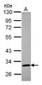 Poly(ADP-Ribose) Polymerase Family Member 11 antibody, NBP2-19699, Novus Biologicals, Western Blot image 