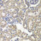 Hexose-6-Phosphate Dehydrogenase/Glucose 1-Dehydrogenase antibody, 22-223, ProSci, Immunohistochemistry paraffin image 