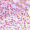 Protein Kinase, DNA-Activated, Catalytic Subunit antibody, LS-C352726, Lifespan Biosciences, Immunohistochemistry paraffin image 