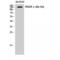 Platelet Derived Growth Factor Receptor Alpha antibody, LS-C385416, Lifespan Biosciences, Western Blot image 