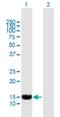 SP140 Nuclear Body Protein antibody, H00011262-B01P, Novus Biologicals, Western Blot image 