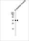 Interferon Gamma Receptor 2 antibody, PA5-72512, Invitrogen Antibodies, Western Blot image 