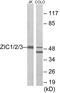 Zic Family Member 1 antibody, EKC1638, Boster Biological Technology, Western Blot image 