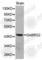 Gamma-Aminobutyric Acid Type A Receptor Gamma2 Subunit antibody, A1733, ABclonal Technology, Western Blot image 