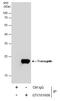 Transgelin antibody, GTX101608, GeneTex, Immunoprecipitation image 