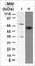 Tumor Protein P73 antibody, PM4831, ECM Biosciences, Western Blot image 