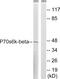 Ribosomal Protein S6 Kinase B2 antibody, abx012928, Abbexa, Western Blot image 