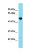 Transmembrane Protein 39A antibody, orb326781, Biorbyt, Western Blot image 