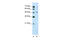 Nuclear Receptor Subfamily 0 Group B Member 1 antibody, 30-074, ProSci, Western Blot image 