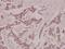 Protein Kinase C Theta antibody, A01293, Boster Biological Technology, Immunohistochemistry paraffin image 