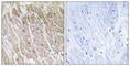 Acyl-CoA Dehydrogenase Family Member 10 antibody, abx014145, Abbexa, Western Blot image 