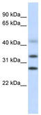 Centromere Protein H antibody, TA344394, Origene, Western Blot image 