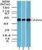 Catalase antibody, NBP2-24916, Novus Biologicals, Western Blot image 
