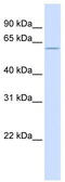 Zinc Finger Protein 703 antibody, TA345414, Origene, Western Blot image 